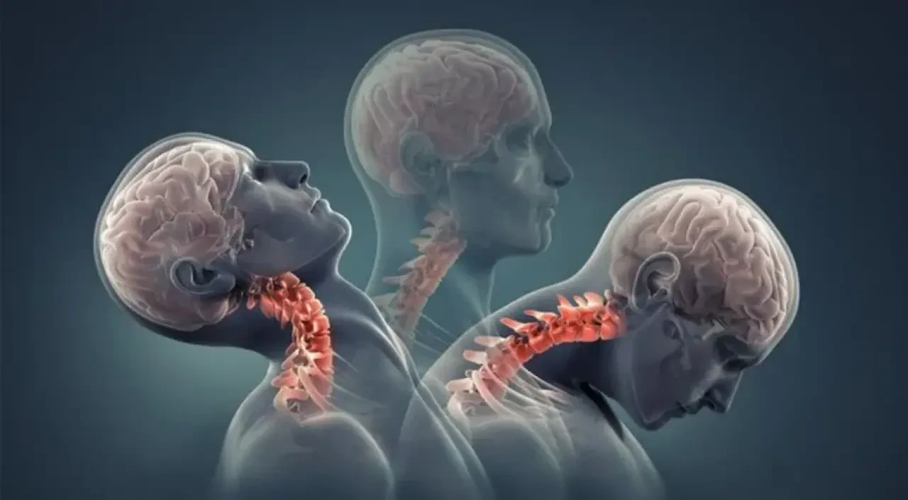Terapi Nedir? Psikolojik Destek ve Tedavi Süreci Hakkında Bilgiler 7