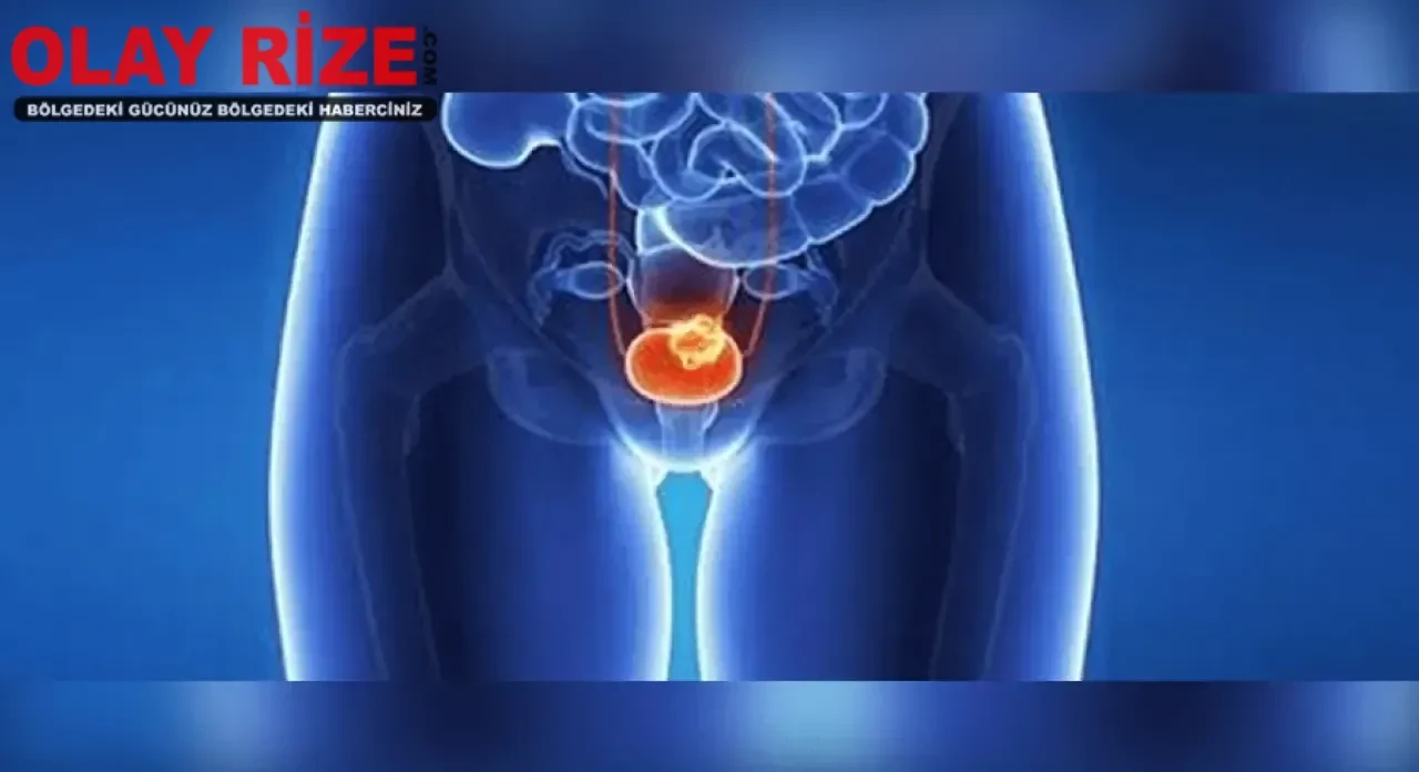 Prostat Kanseri Nedir? Prostat Kanseri Belirtileri, Nedenleri ve Tedavisi