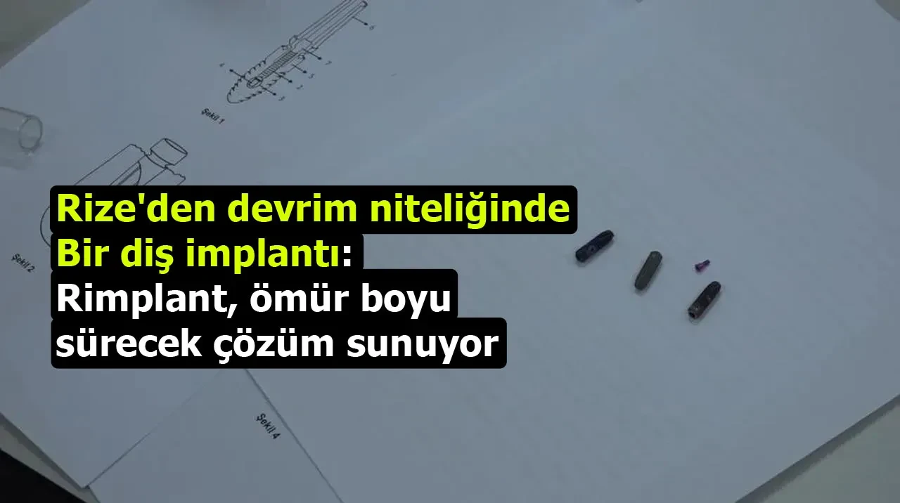 Rize'den devrim niteliğinde bir diş implantı: Rimplant, ömür boyu sürecek çözüm sunuyor