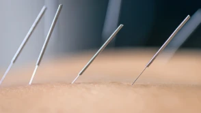 Akupunktur Nedir? Faydaları ve Uygulama Alanları Nelerdir?