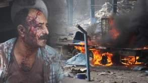 İran'ın en büyük ticari limanında patlama: 25 ölü, 800 yaralı