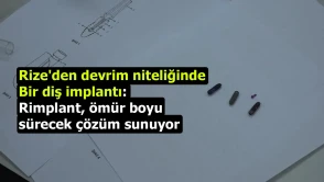 Rize'den devrim niteliğinde bir diş implantı: Rimplant, ömür boyu sürecek çözüm sunuyor