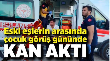 Eski eşlerin arasında çocuk görüş gününde kan aktı