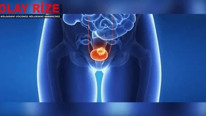Prostat Kanseri Nedir? Prostat Kanseri Belirtileri, Nedenleri ve Tedavisi