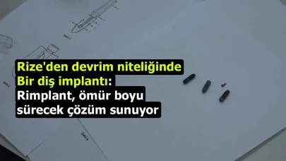 Rize'den devrim niteliğinde bir diş implantı: Rimplant, ömür boyu sürecek çözüm sunuyor