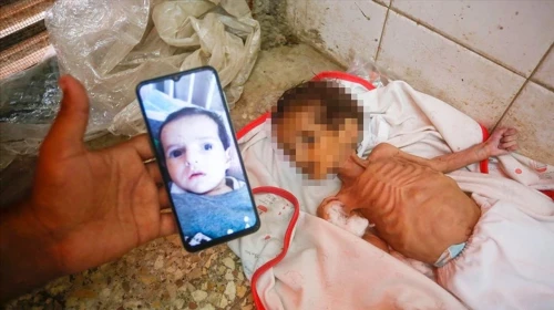 Gazze'de Abluka Kurbanı: Sağlıklı Bebek Mama Yokluğunda Hayatını Kaybetti