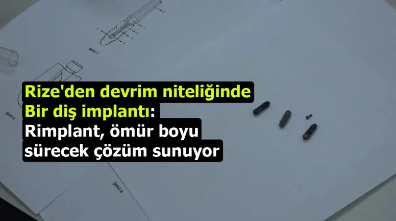 Rize'den devrim niteliğinde bir diş implantı: Rimplant, ömür boyu sürecek çözüm sunuyor