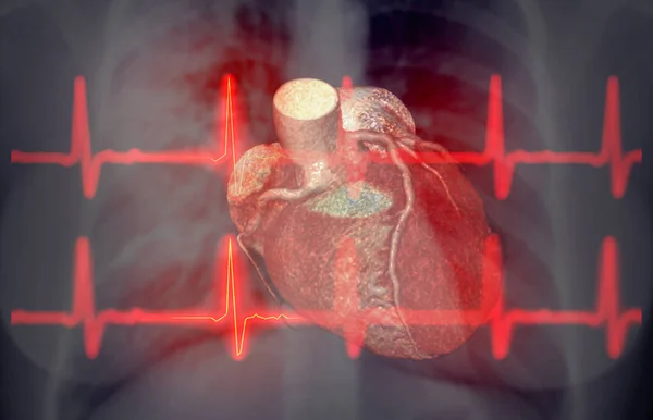 Kalp Hastaları Oruç Tutabilir mi? Kalp Hastaları ve Oruç: Riskler ve Öneriler