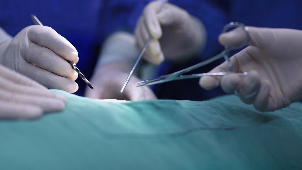 Cinsiyet Uyum Ameliyatı: Cinsel Kimlik ve Cerrahi Müdahale