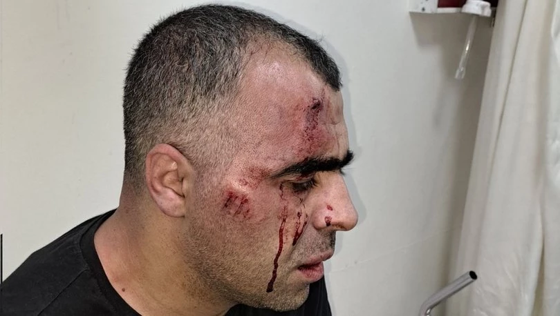 Bitlis Gazeteciler Cemiyeti Başkanı Gazeteci Sinan Aygül saldırıya uğradı